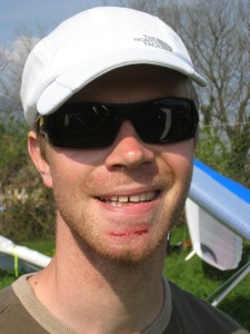 Nils with wireburn